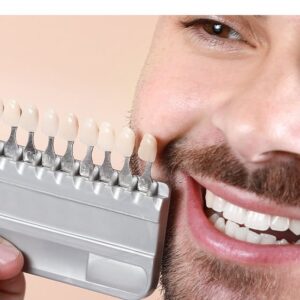 Dentist matching porcelain veneers shade to patient's teeth using color guide during consultation