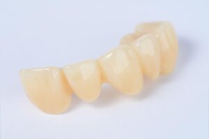 Dental Crowns