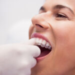 Beverly Hills Invisalign